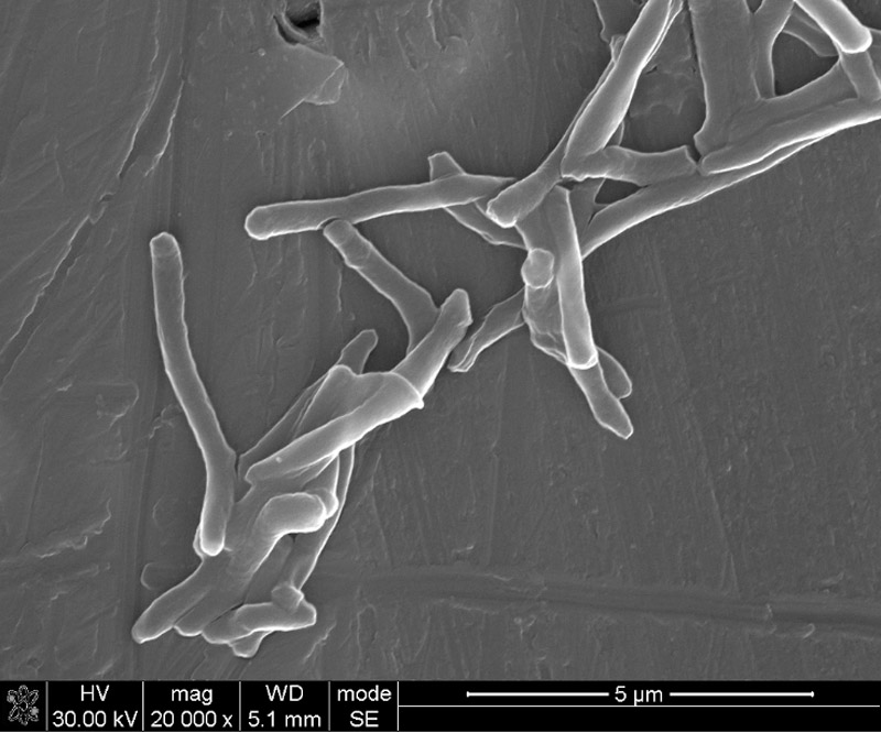 Electron micrograph of mycobacterial cells...